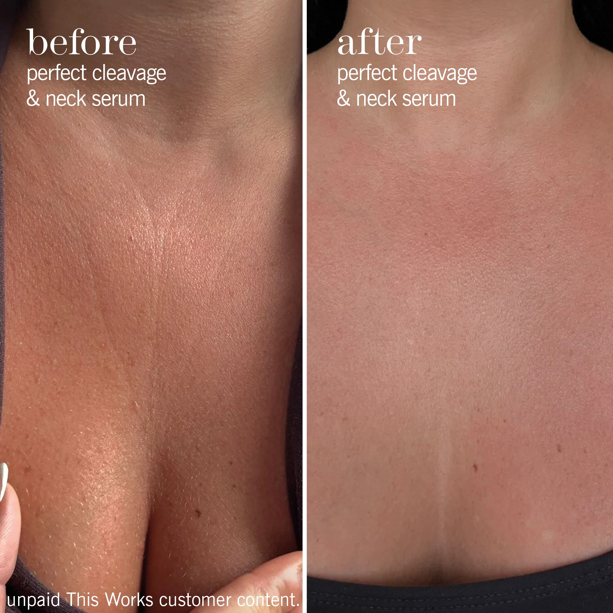 camera-ready neck & décolletage set - Image 5